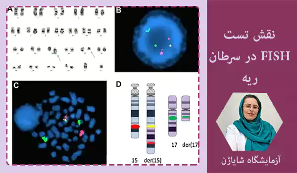 نقش تست FISH در سرطان ریه